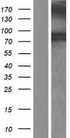 RHOBTB2 / DBC2 Protein (Over-Expression Lysate Myc-DDK (Flag))