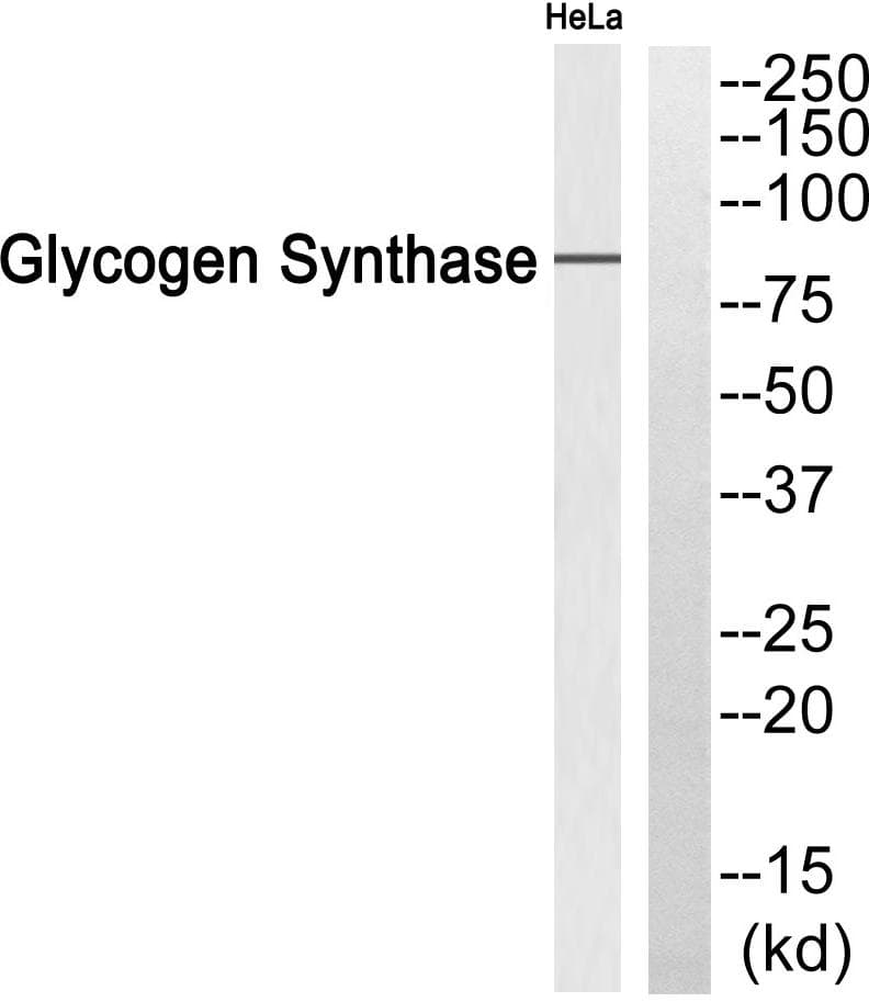 GYS1 / Glycogen Synthase Antibody (p641)