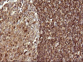 SCAMP2 Antibody (clone OTI3C2)