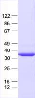 Human NDUFAF5 Protein (Recombinant His, N-Terminal)