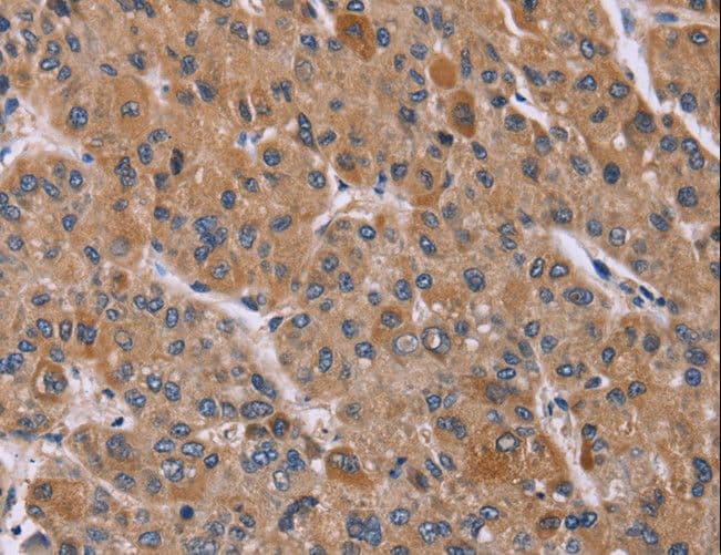 PPIF / Cyclophilin F Antibody