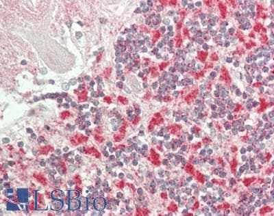 IHC-plus™ CYP4Z1 Antibody (Internal)
