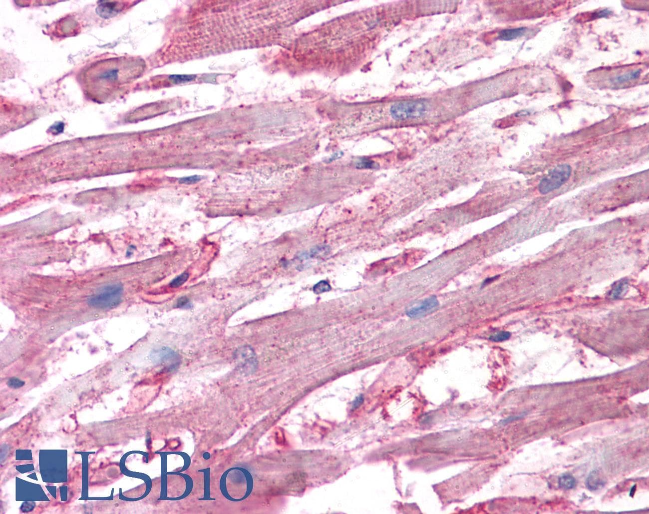 IHC-plus™ ATP6V1D / V-ATPase subunit D Antibody (clone 3G4)