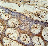 Polyclonal Rabbit anti-Human ZC3H3 Antibody (aa920-948, IHC, WB)