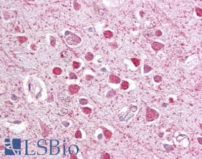 IHC-plus™ CEBPG / CEBP Gamma Antibody (aa139-150)