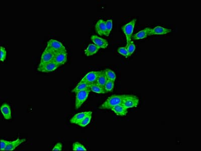 BTRCP / BETA-TRCP Antibody