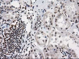 PRKCE / PKC-Epsilon Antibody (clone OTI1B4)