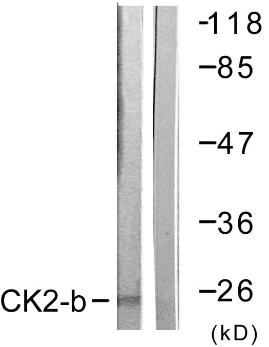 CSNK2B / Phosvitin Antibody (aa166-215)