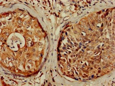 CDKN1A / WAF1 / p21 Antibody