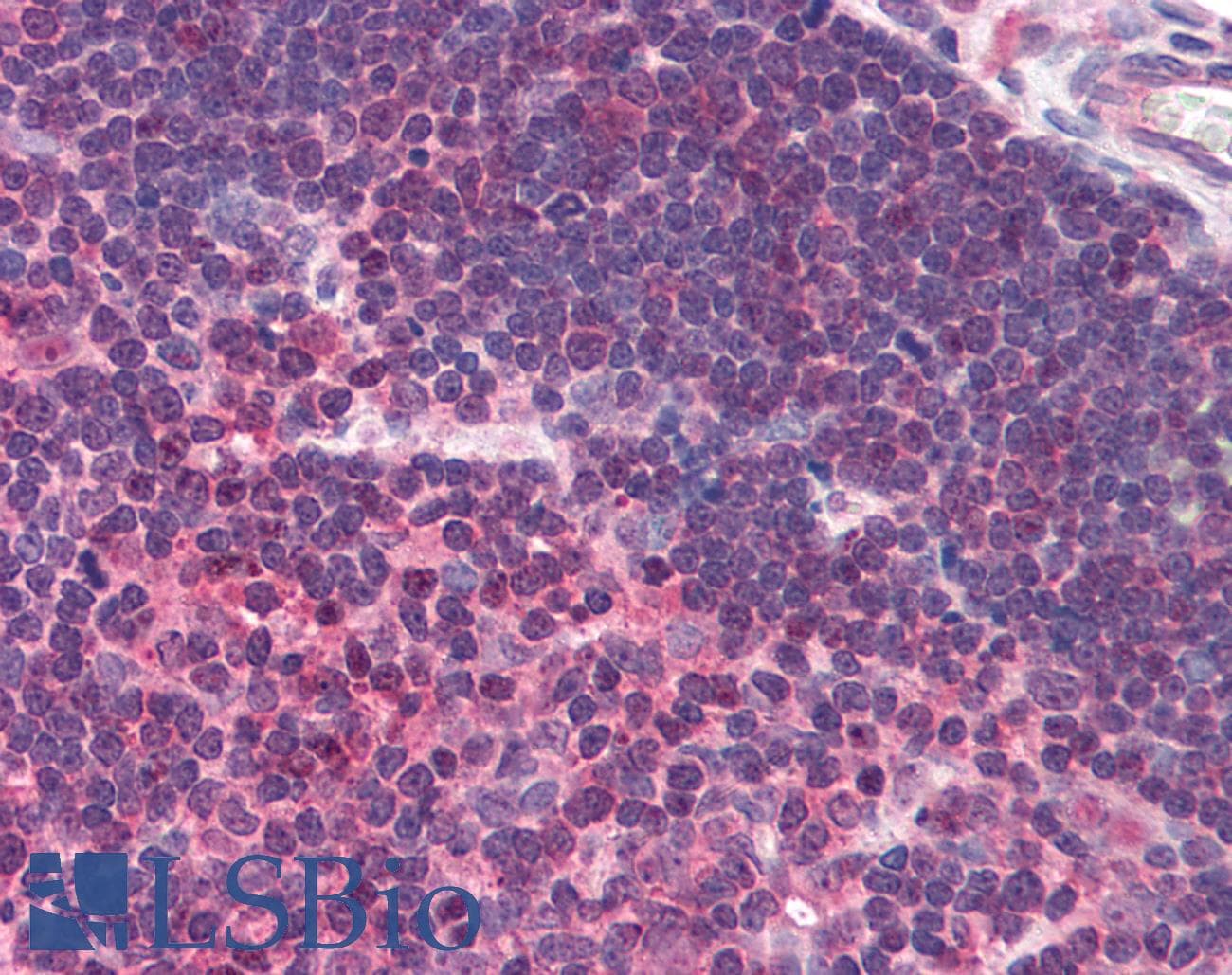 IHC-plus™ UNC13D Antibody (aa967-980)