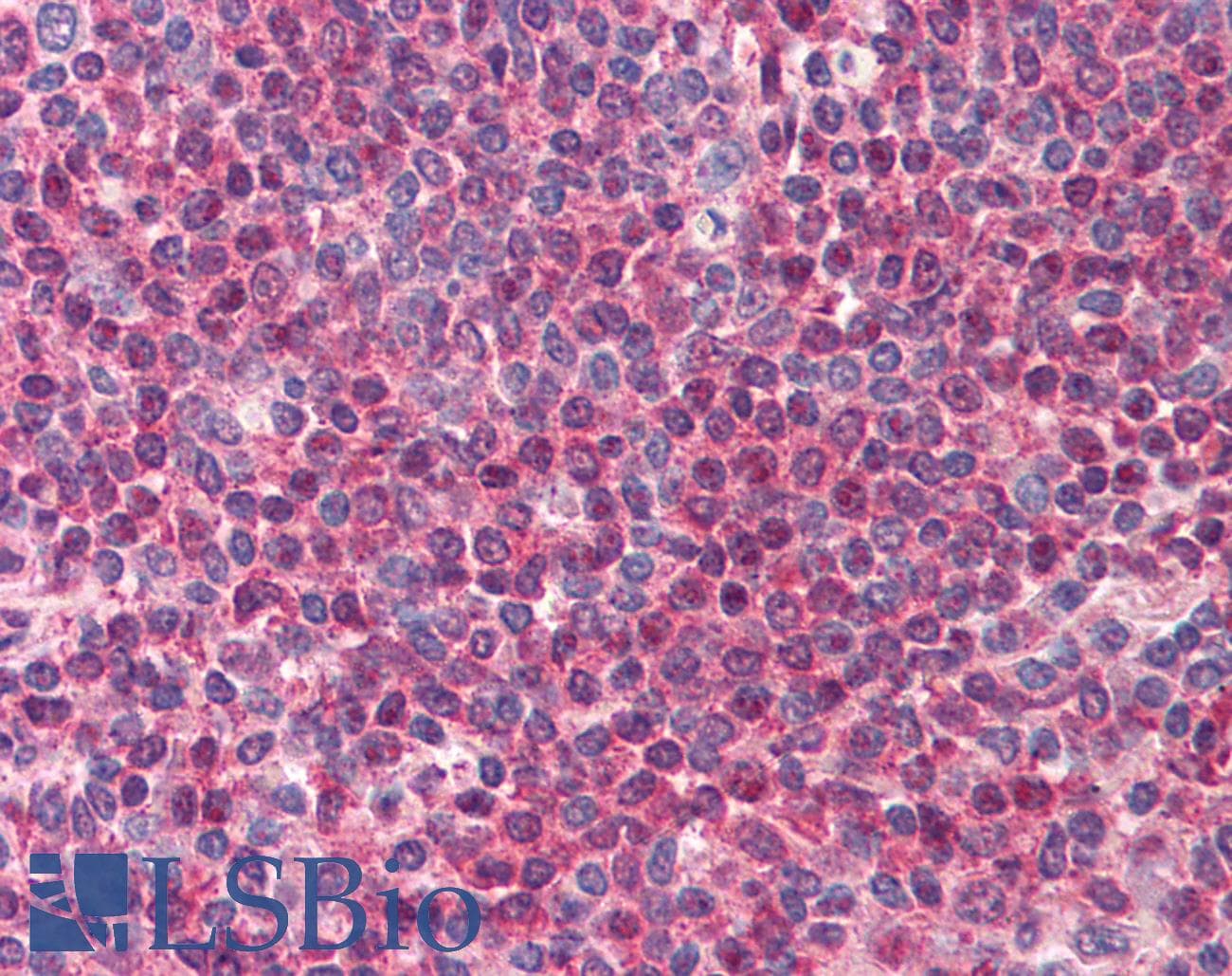 IHC-plus™ TIRAP Antibody