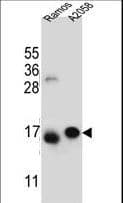 EIF5AL1 Antibody (aa94-122)