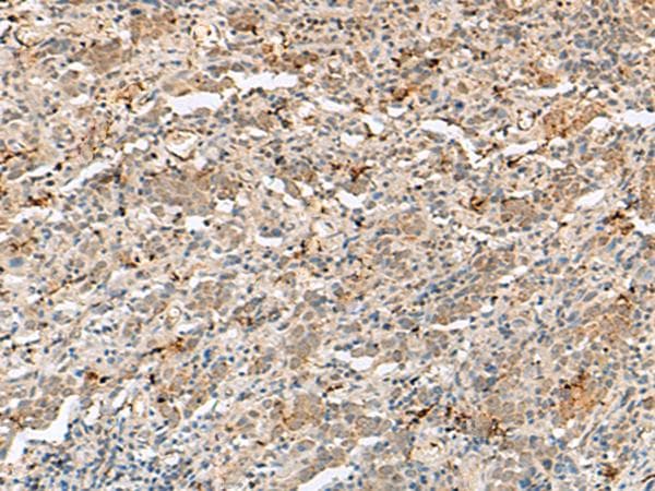 Polyclonal Rabbit anti-Human H3F3B Antibody (IHC)