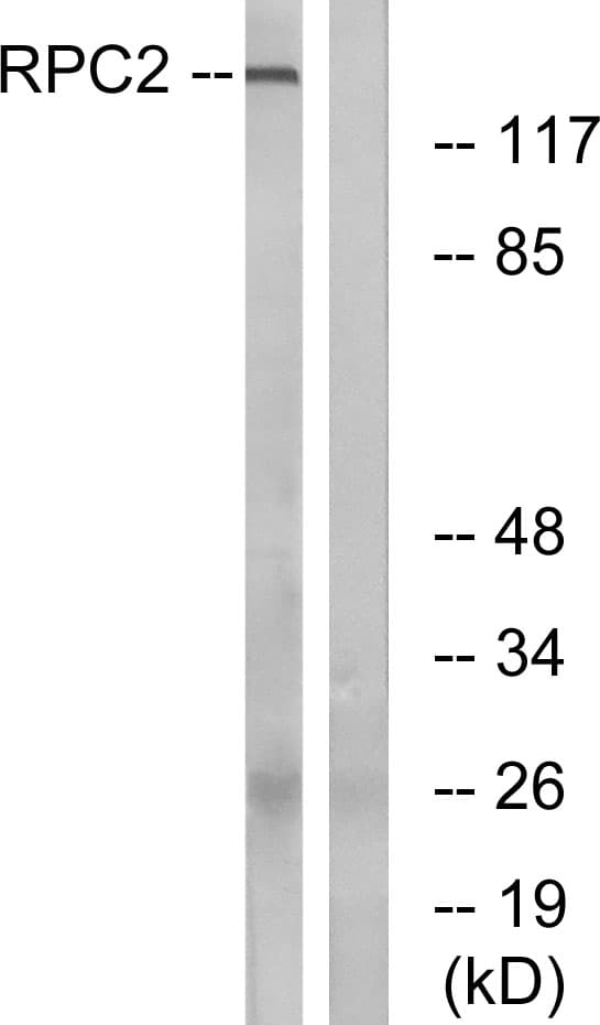 Polyclonal Rabbit anti-Human POLR3B Antibody (aa321-370, WB)