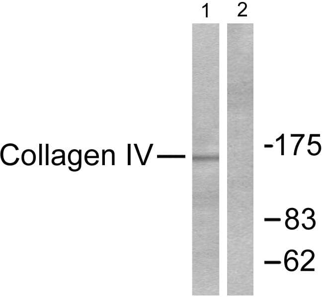 Collagen IV Antibody (aa11-60)