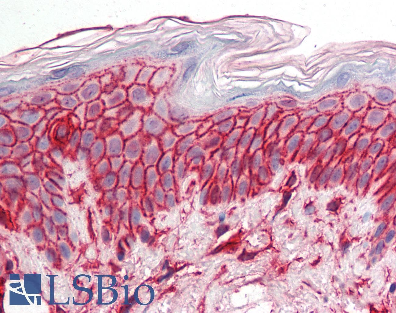 IHC-plus™ CD44 Antibody