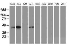 SMS / Spermine Synthase Antibody (clone OTI 1A7)