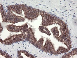 DPH2 Antibody (clone OTI2B12)