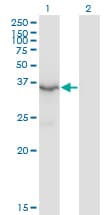HSD3B2 Antibody (clone 1E8)
