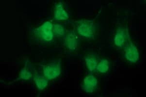 PDGFRB / PDGFR Beta Antibody (clone OTI1D2)