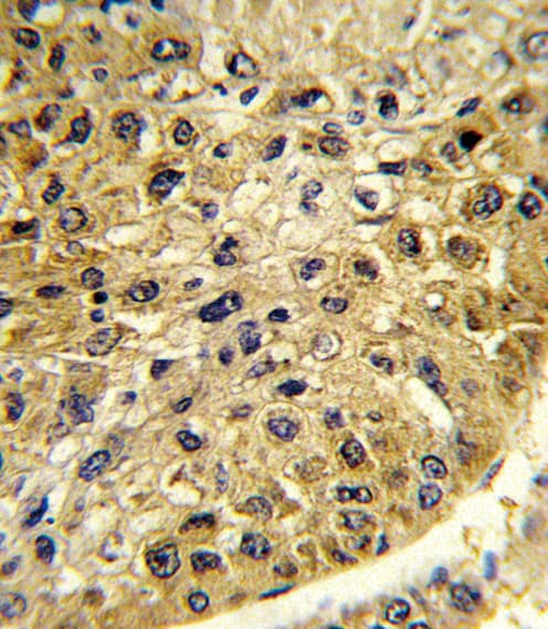 DCT / Dopachrome Tautomerase Antibody (aa62-89)