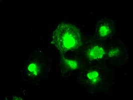 Monoclonal Mouse anti-Human MRI1 Antibody (clone OTI6G9, IHC, IF, WB)