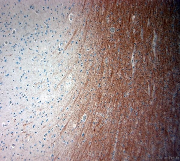 Polyclonal Rabbit anti-Human MBP / Maltose Binding Protein Antibody (aa180-220, IHC)