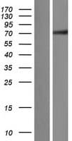 ZNF131 Protein (Over-Expression Lysate Myc-DDK (Flag))