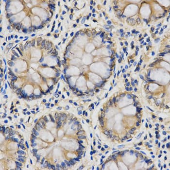 IL27 Antibody