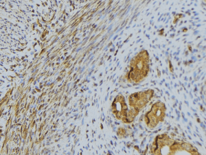 RNASE13 Antibody