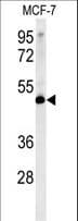 LSP1 Antibody (aa108-134)