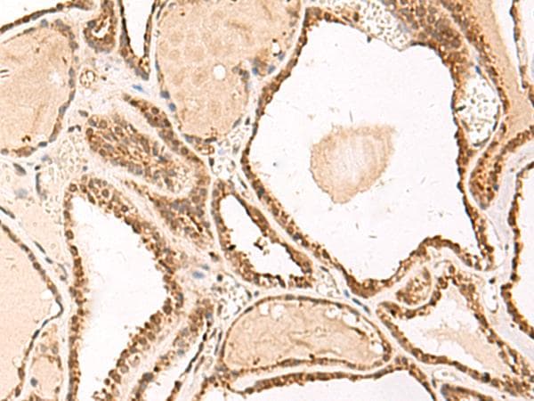 FUNDC2 Antibody