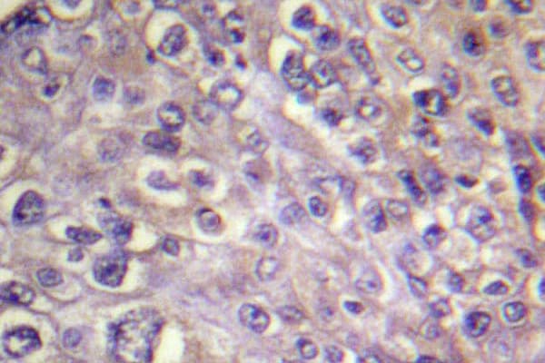 Polyclonal Rabbit anti-Human RHOA Antibody (Arg182, IHC, WB)