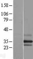 Human PARL / PSARL Protein (Over-Expression Lysate Myc-DDK (Flag))
