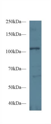 EPHA1 / EPH Receptor A1 Antibody (aa716-960, APC)
