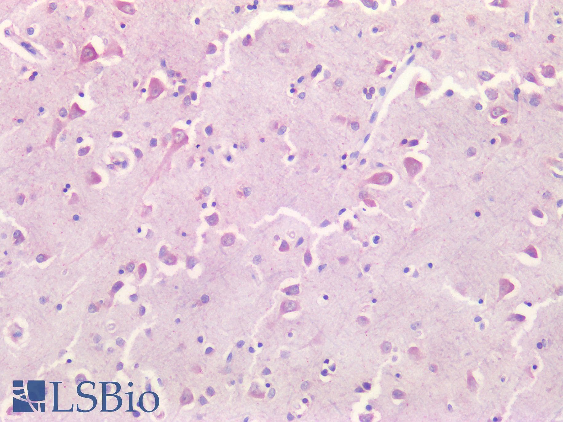 PathPlus™ BIRC5 / Survivin Antibody (aa154-165)