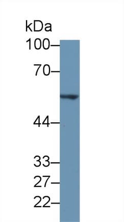 TH / Tyrosine Hydroxylase Antibody (aa45-214, PE)