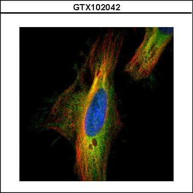 DIAPH1 Antibody (aa1-237)