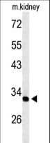 TMUB2 Antibody (aa83-112)