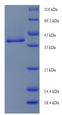 Cynops pyrrhogaster ANXA5 / Annexin V Protein (Recombinant His)