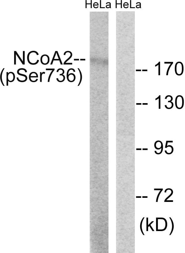 NCOA2 / TIF2 Antibody (phospho-Ser736)