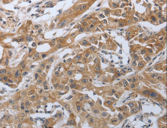 PDCD1 / CD279 / PD-1 Antibody