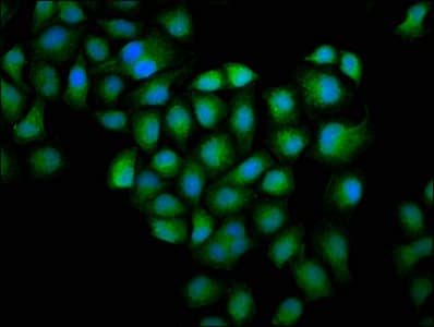 GSN / Gelsolin Antibody (aa28-782)