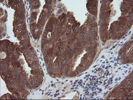 MAP2K1 / MKK1 / MEK1 Antibody (clone OTI4E1)