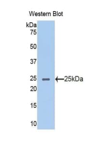 ACHE / Acetylcholinesterase Antibody (aa367-549, Cy3)