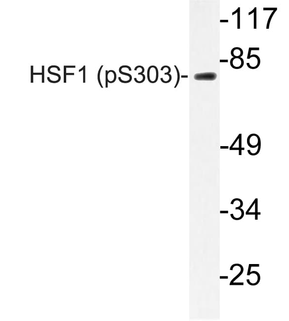 Polyclonal Rabbit anti-Human HSF1 Antibody (phospho-Ser303, IHC, IF, WB)