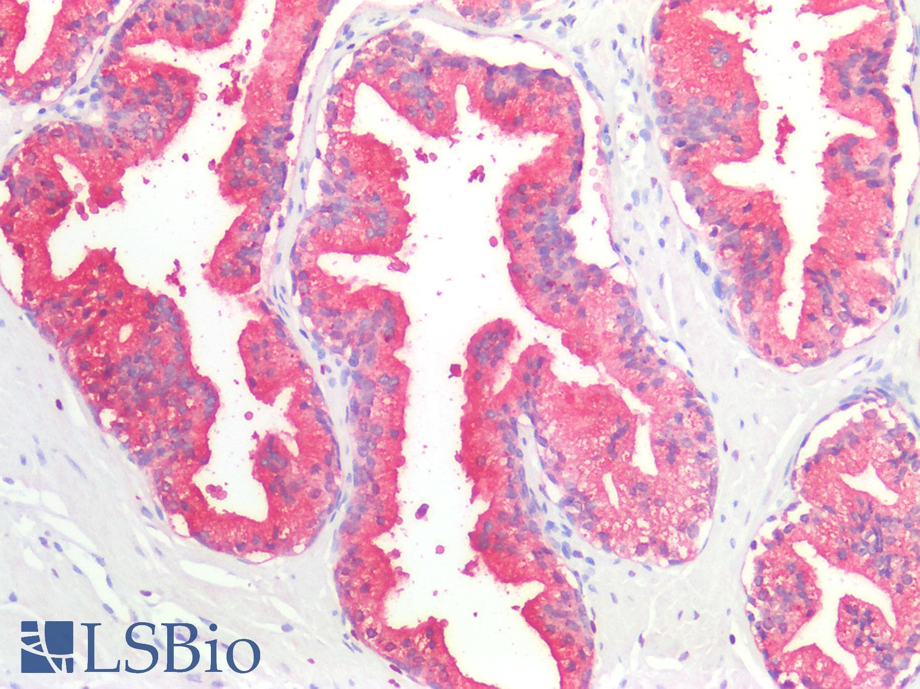 PathPlus™ Polyclonal Rabbit anti-Human ACPP / PAP Antibody (IHC, WB)