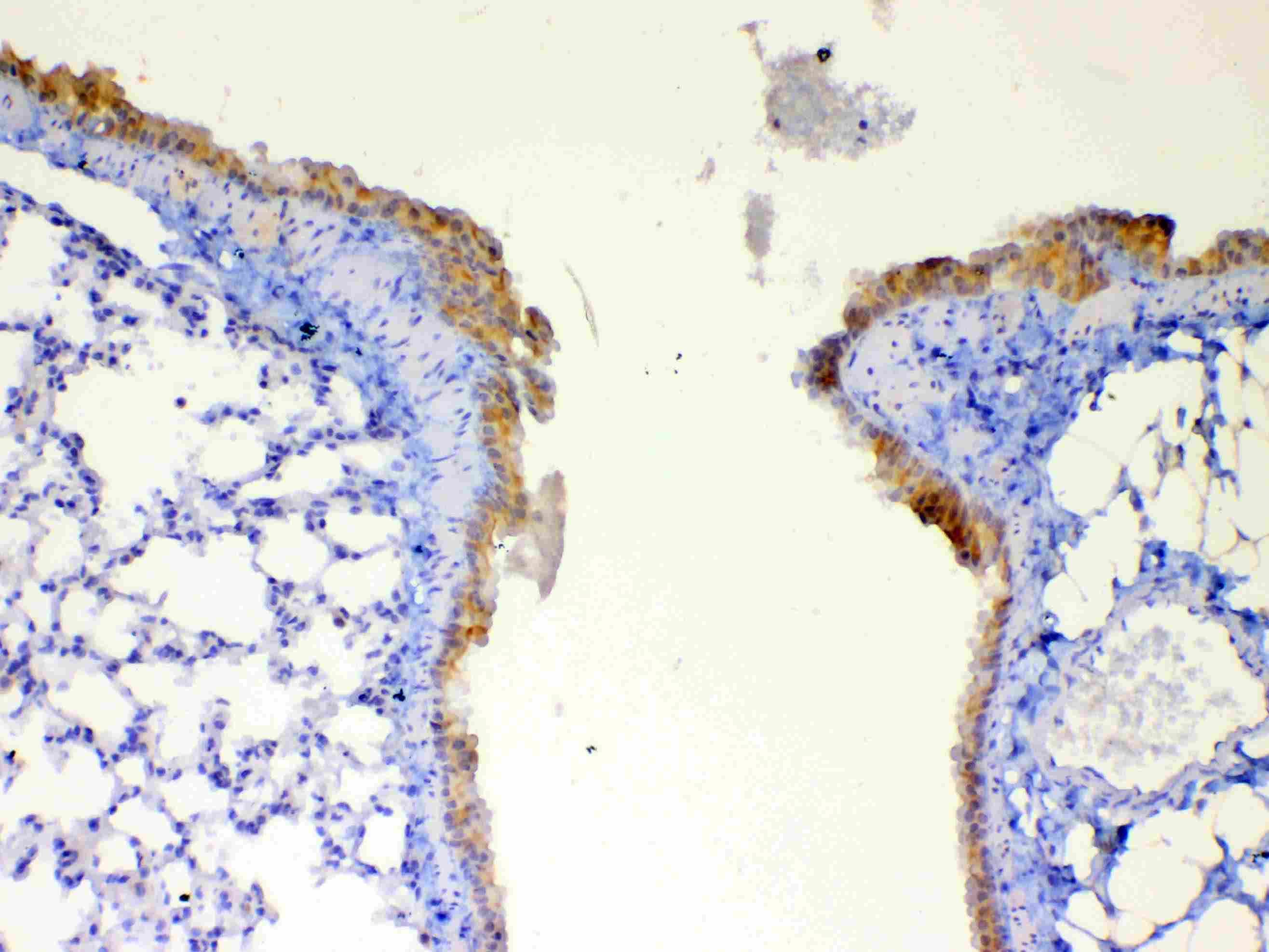Polyclonal Rabbit anti-Human DYNLT1 / TCTEX-1 Antibody (IHC, WB)