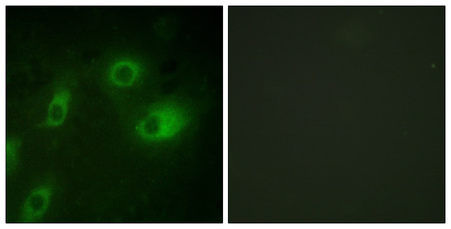 KRT18 / CK18 / Cytokeratin 18 Antibody (phospho-Ser52)