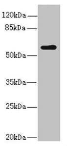 Polyclonal Rabbit anti-Human KPNA5 Antibody (IHC, WB)
